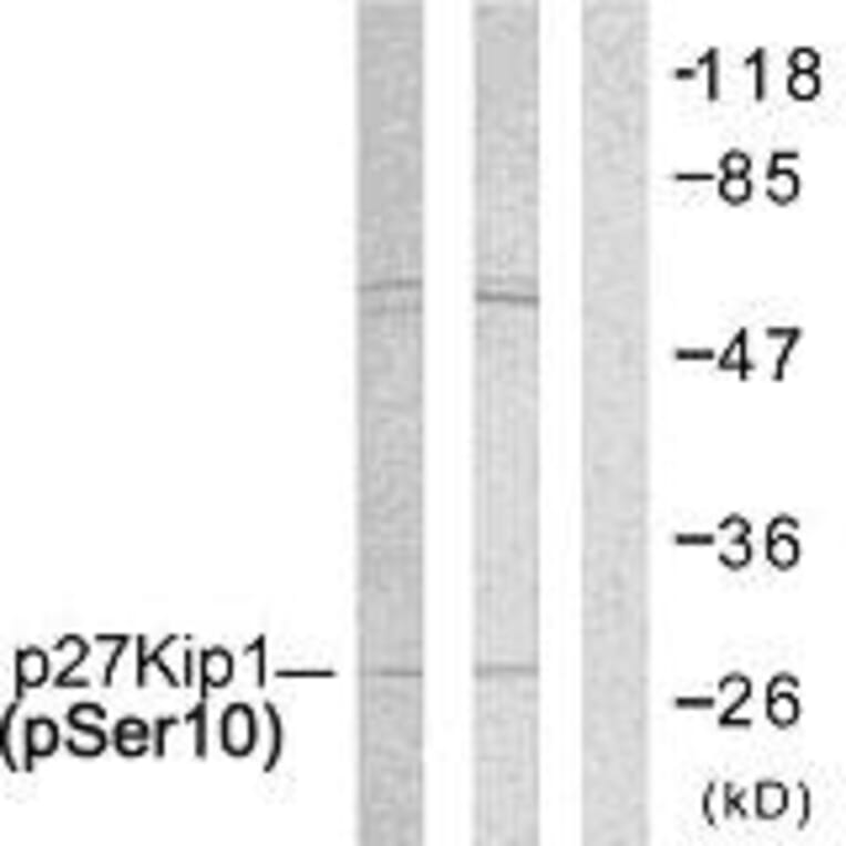 Western Blot - Anti-p27 Kip1 (phospho Ser10) Antibody (A7176) - Antibodies.com