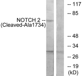 Western Blot - Anti-NOTCH2 (cleaved Ala1734) Antibody (L0352) - Antibodies.com