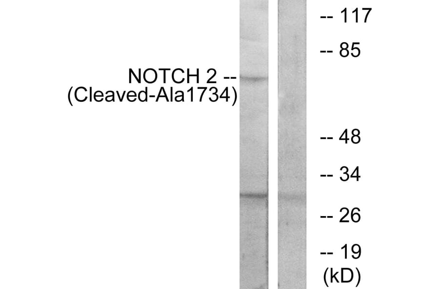 Western Blot - Anti-NOTCH2 (cleaved Ala1734) Antibody (L0352) - Antibodies.com