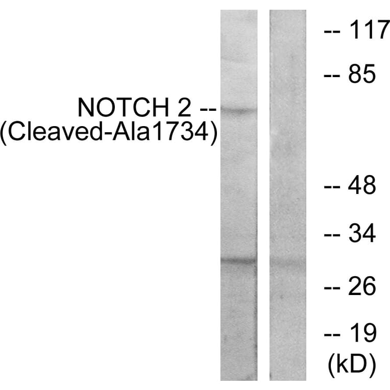 Western Blot - Anti-NOTCH2 (cleaved Ala1734) Antibody (L0352) - Antibodies.com