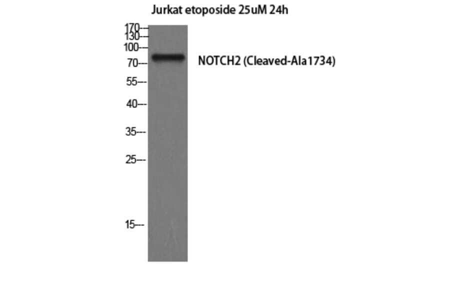Western Blot - Anti-NOTCH2 (cleaved Ala1734) Antibody (L0352) - Antibodies.com