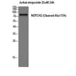 Western Blot - Anti-NOTCH2 (cleaved Ala1734) Antibody (L0352) - Antibodies.com