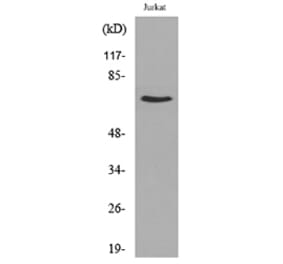 Western Blot - Anti-NF?B-p65 (acetyl Lys218) Antibody (D12160) - Antibodies.com