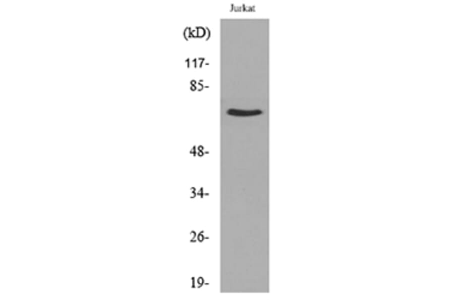 Western Blot - Anti-NFκB-p65 (acetyl Lys218) Antibody (D12160) - Antibodies.com