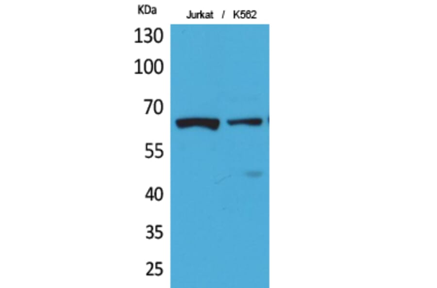 Western Blot - Anti-NFκB-p65 (acetyl Lys218) Antibody (D12160) - Antibodies.com