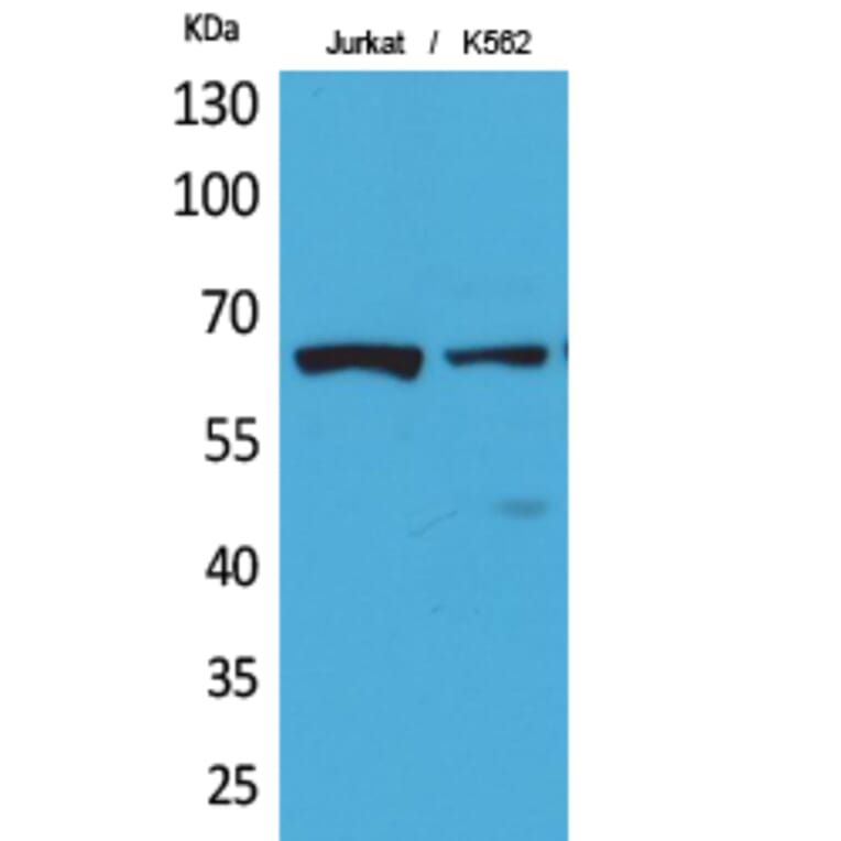 Western Blot - Anti-NFκB-p65 (acetyl Lys218) Antibody (D12160) - Antibodies.com