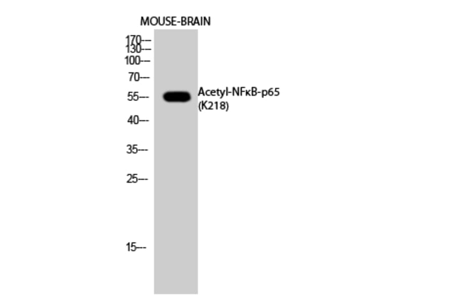 Western Blot - Anti-NFκB-p65 (acetyl Lys218) Antibody (D12160) - Antibodies.com
