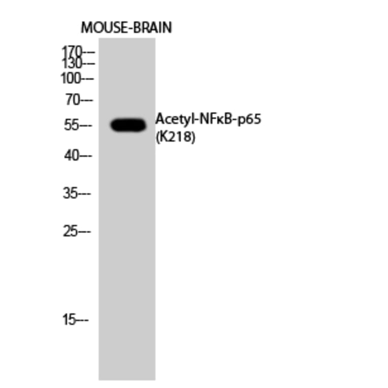 Western Blot - Anti-NFκB-p65 (acetyl Lys218) Antibody (D12160) - Antibodies.com