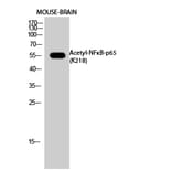 Western Blot - Anti-NFκB-p65 (acetyl Lys218) Antibody (D12160) - Antibodies.com