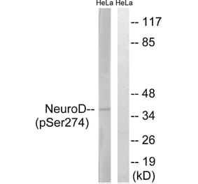 Western Blot - Anti-Neuro D (phospho Ser274) Antibody (A8383) - Antibodies.com