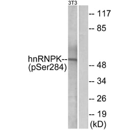 Western Blot - Anti-hnRNP K (phospho Ser284) Antibody (A1042) - Antibodies.com