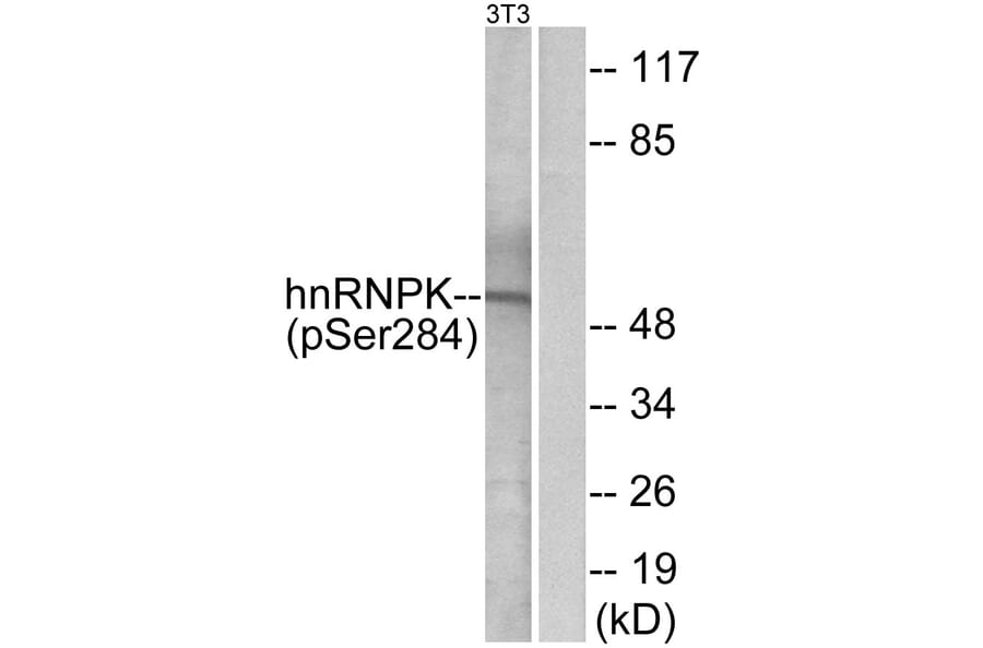 Western Blot - Anti-hnRNP K (phospho Ser284) Antibody (A1042) - Antibodies.com