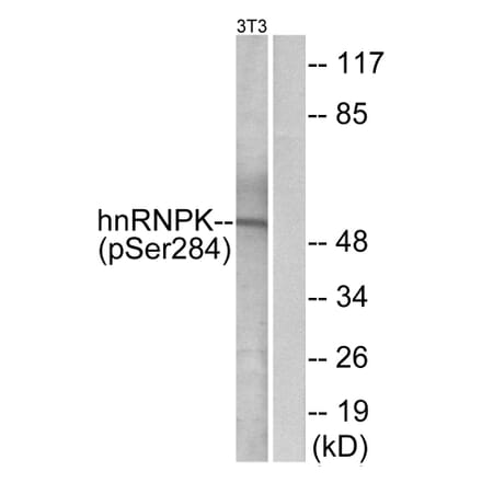 Western Blot - Anti-hnRNP K (phospho Ser284) Antibody (A1042) - Antibodies.com