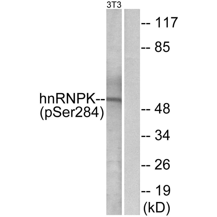Western Blot - Anti-hnRNP K (phospho Ser284) Antibody (A1042) - Antibodies.com