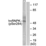 Western Blot - Anti-hnRNP K (phospho Ser284) Antibody (A1042) - Antibodies.com
