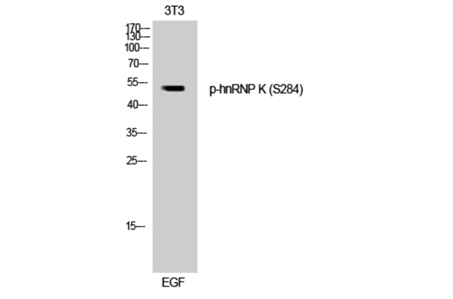 Western Blot - Anti-hnRNP K (phospho Ser284) Antibody (A1042) - Antibodies.com