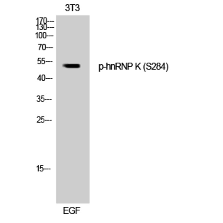 Western Blot - Anti-hnRNP K (phospho Ser284) Antibody (A1042) - Antibodies.com