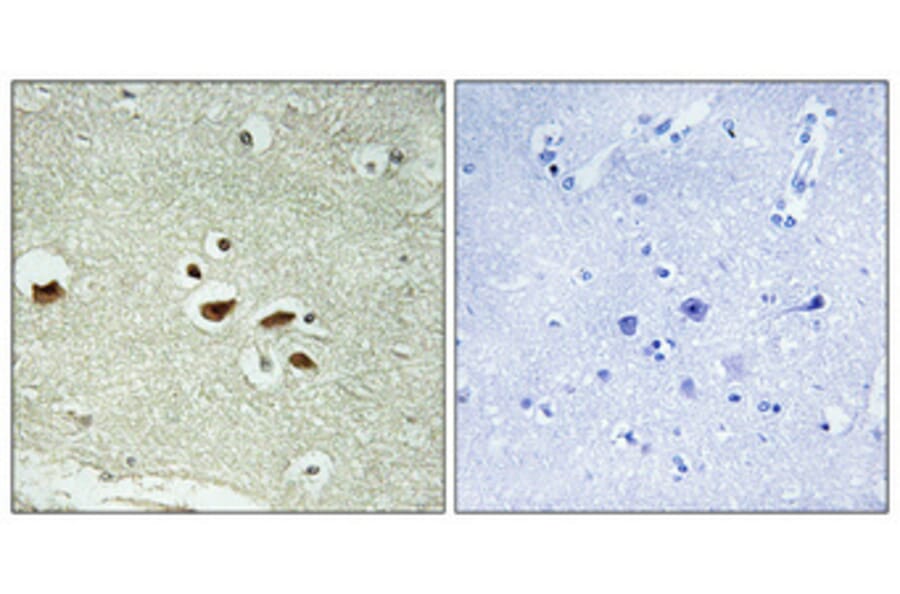 Immunohistochemistry - Anti-hnRNP K (phospho Ser284) Antibody (A1042) - Antibodies.com