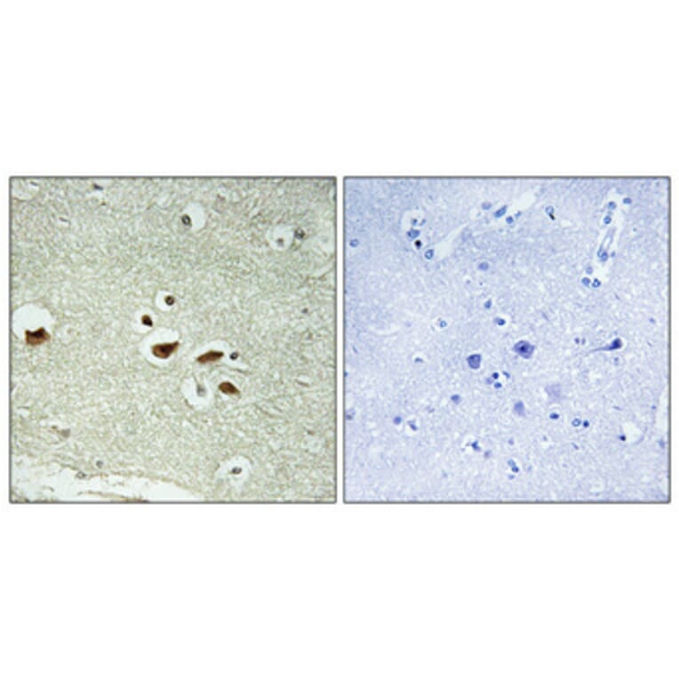 Immunohistochemistry - Anti-hnRNP K (phospho Ser284) Antibody (A1042) - Antibodies.com