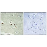 Immunohistochemistry - Anti-hnRNP K (phospho Ser284) Antibody (A1042) - Antibodies.com