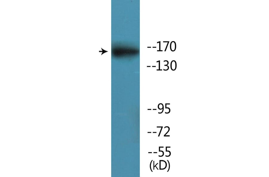 Western Blot - Anti-GRIN2B (phospho Ser1303) Antibody (P12-1111) - Antibodies.com