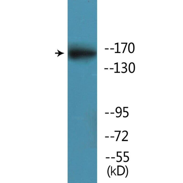 Western Blot - Anti-GRIN2B (phospho Ser1303) Antibody (P12-1111) - Antibodies.com