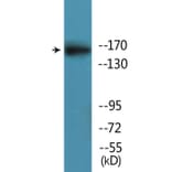 Western Blot - Anti-GRIN2B (phospho Ser1303) Antibody (P12-1111) - Antibodies.com