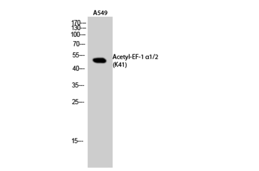 Western Blot - Anti-EEF1A-pan (acetyl Lys41) Antibody (D12106) - Antibodies.com
