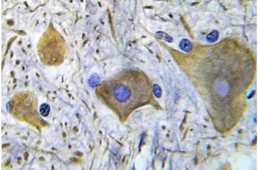 Immunohistochemistry - Anti-NMDAR1 (phospho Ser896) Antibody (P12-1037) - Antibodies.com