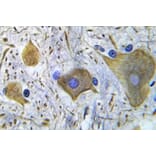 Immunohistochemistry - Anti-NMDAR1 (phospho Ser896) Antibody (P12-1037) - Antibodies.com