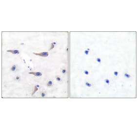 Immunohistochemistry - Anti-MARCKS (phospho Ser163) Antibody (A7143) - Antibodies.com