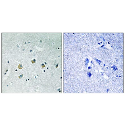 Immunohistochemistry - Anti-MAP3K8 (phospho Ser400) Antibody (A8134) - Antibodies.com