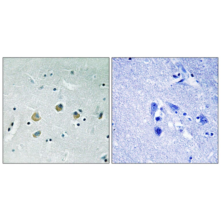 Immunohistochemistry - Anti-MAP3K8 (phospho Ser400) Antibody (A8134) - Antibodies.com