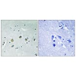 Immunohistochemistry - Anti-MAP3K8 (phospho Ser400) Antibody (A8134) - Antibodies.com