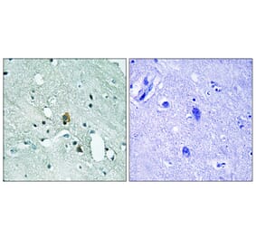 Immunohistochemistry - Anti-IP3R1 (phospho Ser1764) Antibody (A8355) - Antibodies.com