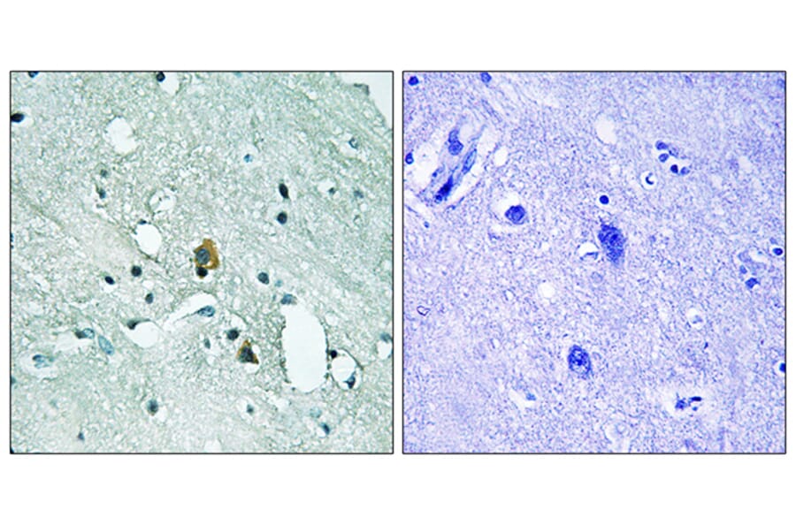 Immunohistochemistry - Anti-IP3R1 (phospho Ser1764) Antibody (A8355) - Antibodies.com