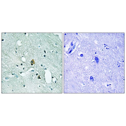 Immunohistochemistry - Anti-IP3R1 (phospho Ser1764) Antibody (A8355) - Antibodies.com