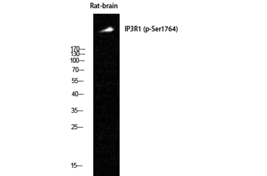 Western Blot - Anti-IP3R1 (phospho Ser1764) Antibody (A8355) - Antibodies.com