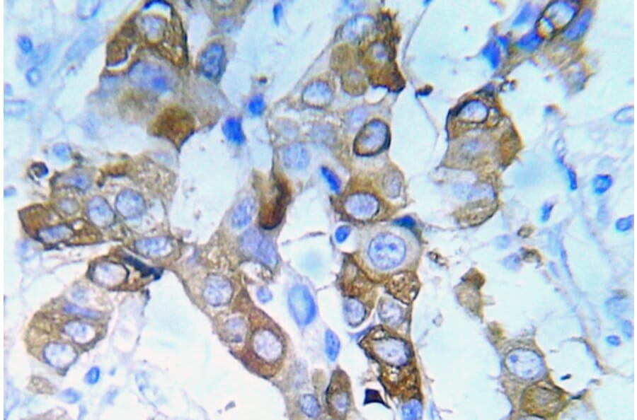 Immunohistochemistry - Anti-IGF-IR (phospho Tyr980) Antibody (P12-1029) - Antibodies.com