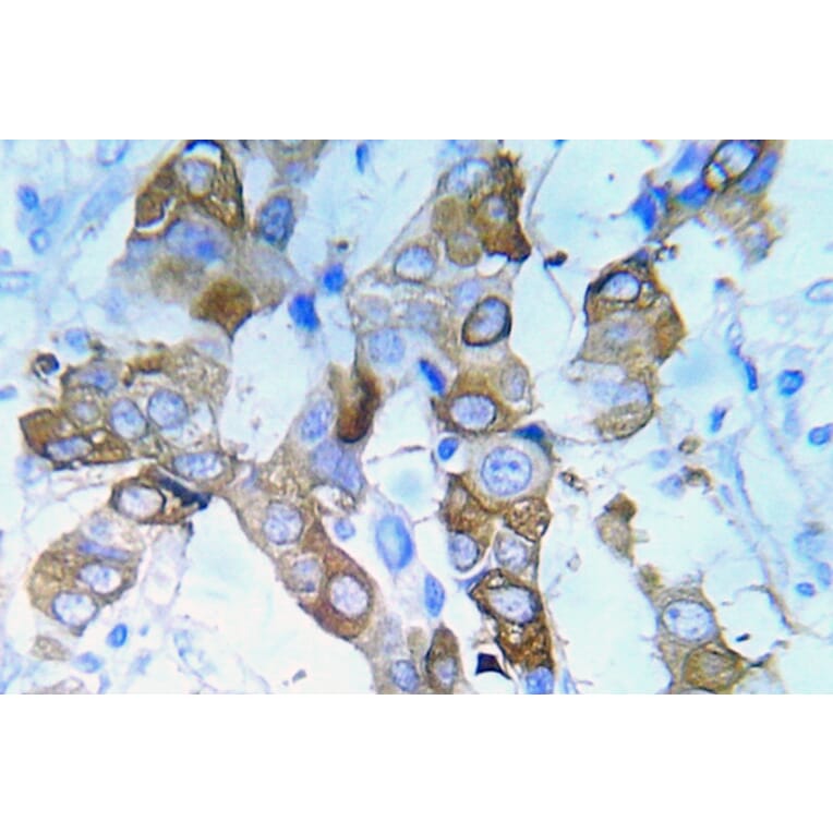 Immunohistochemistry - Anti-IGF-IR (phospho Tyr980) Antibody (P12-1029) - Antibodies.com