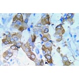 Immunohistochemistry - Anti-IGF-IR (phospho Tyr980) Antibody (P12-1029) - Antibodies.com