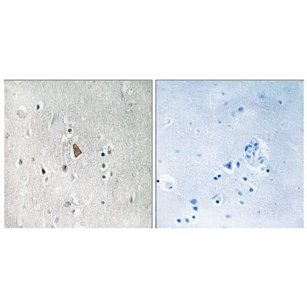 Immunohistochemistry - Anti-IGF1R (phospho Tyr1346) Antibody (A8042) - Antibodies.com