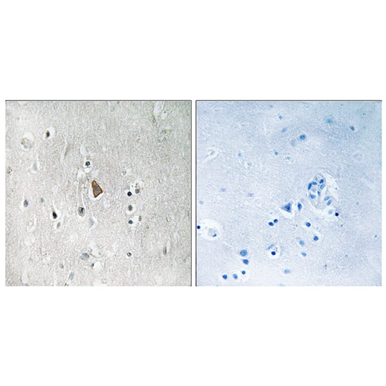 Immunohistochemistry - Anti-IGF1R (phospho Tyr1346) Antibody (A8042) - Antibodies.com