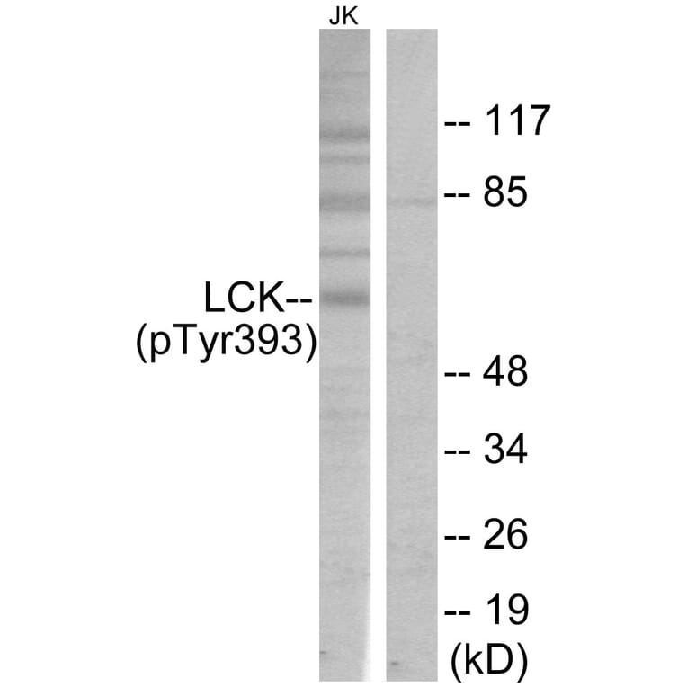 Western Blot - Anti-Lck (phospho Tyr393) Antibody (A7139) - Antibodies.com