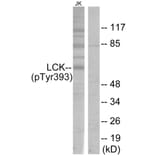 Western Blot - Anti-Lck (phospho Tyr393) Antibody (A7139) - Antibodies.com