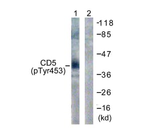 Western Blot - Anti-CD5 (phospho Tyr453) Antibody (A0849) - Antibodies.com