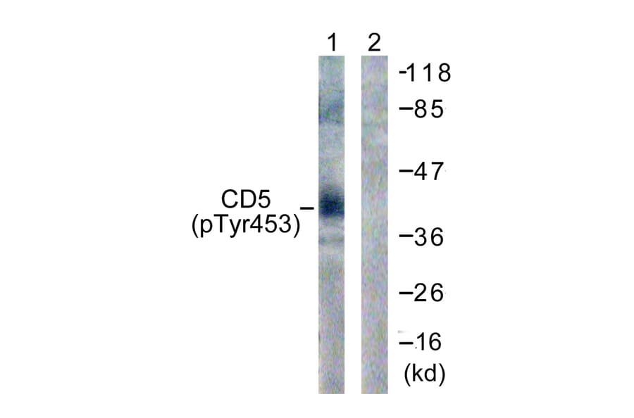 Western Blot - Anti-CD5 (phospho Tyr453) Antibody (A0849) - Antibodies.com
