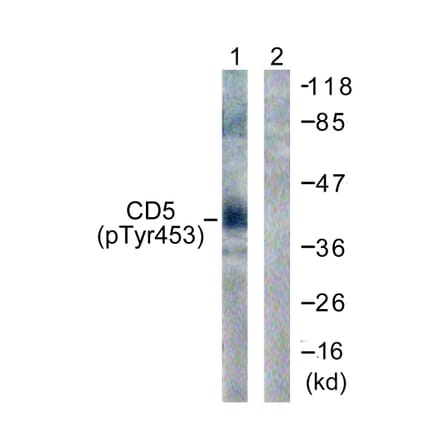 Western Blot - Anti-CD5 (phospho Tyr453) Antibody (A0849) - Antibodies.com