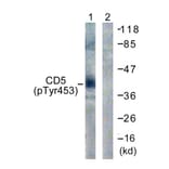 Western Blot - Anti-CD5 (phospho Tyr453) Antibody (A0849) - Antibodies.com