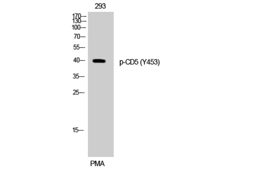Western Blot - Anti-CD5 (phospho Tyr453) Antibody (A0849) - Antibodies.com